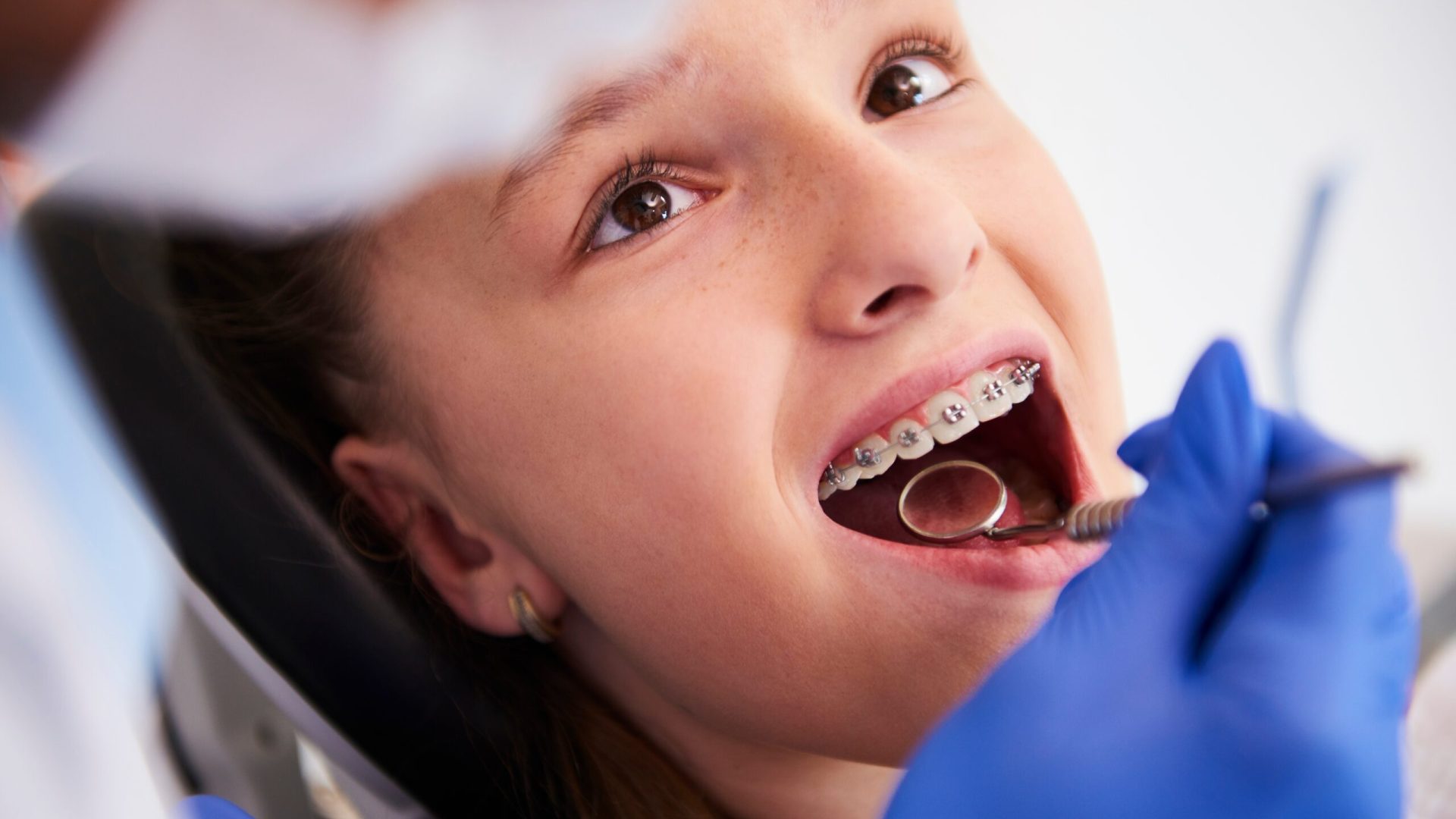 Orthodontic treatments